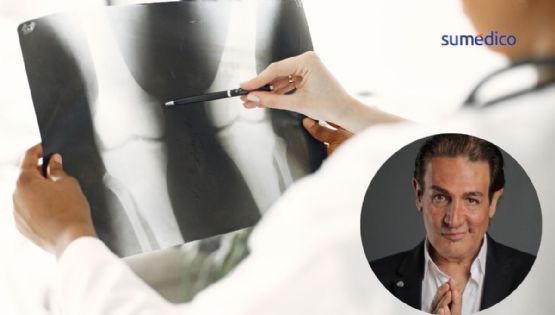 ¿Qué tan grave es una fisura de fémur como la que sufrió Fabián Lavalle?