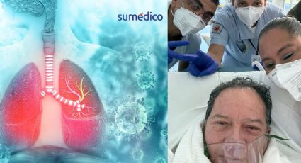 ¿Qué significa la terapia intermedia en la que se encuentra 'Coque' Muñiz por covid?
