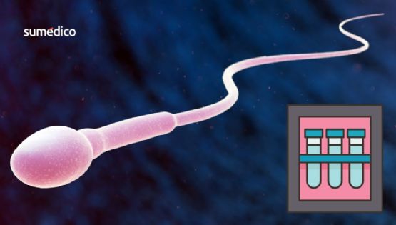 ¿Por qué un donante de esperma causó 10 casos de cáncer infantil? Esto sabemos