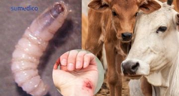 ¿Qué es la miasis por gusano barrenador y cómo detectarlo?