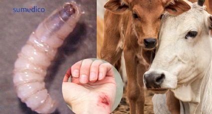 ¿Qué es la miasis por gusano barrenador y cómo detectarlo?