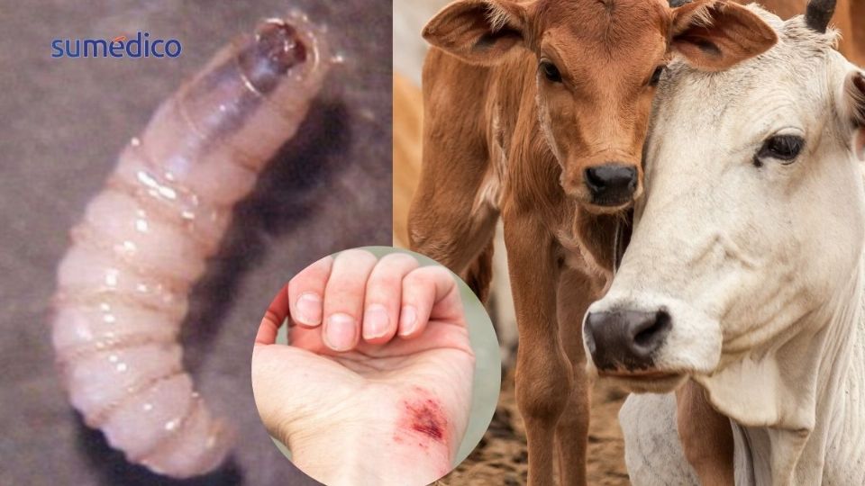 La miasis por gusano barrenador no es común en humanos.