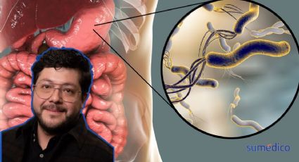 ¿Cómo saber que tienes la bacteria que aumenta el riesgo de cáncer de estómago? Experto te dice