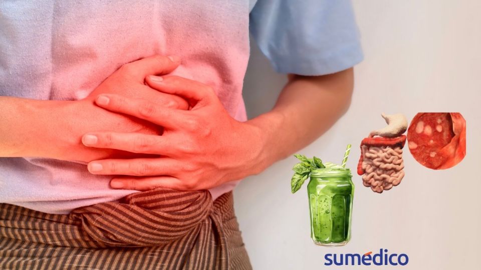 Descubre el jugo que debes tomar si tienes colitis