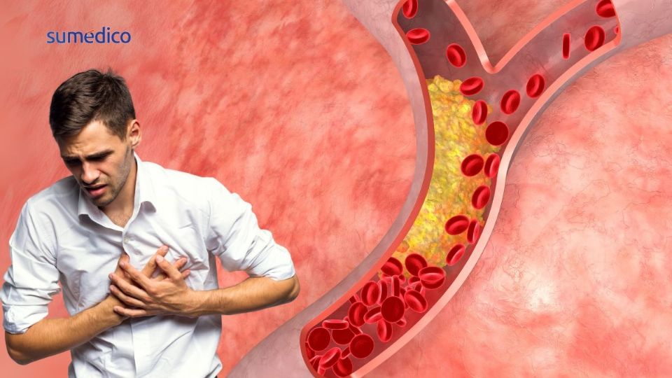 Factores como fumar, comer azúcares y grasas en exceso aumentan el riesgo.