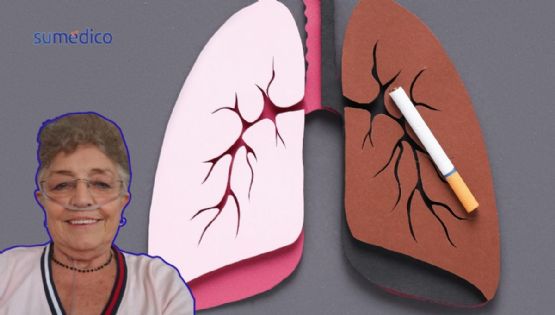 'Fumaba hasta dos cajetillas al día y a los 61 años me diagnosticaron EPOC'
