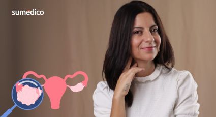 'Pensé que me dolía el apéndice, en realidad tenía cáncer de ovario'
