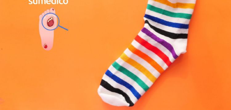 Calcetines para diabéticos: ¿Cómo saber que los necesitas?