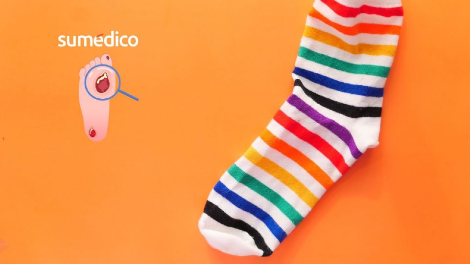 Los calcetines para diabéticos son una herramienta de prevención.