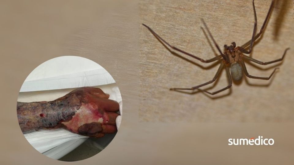 La araña violinista es común en temporada de calor.