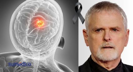 ¿Qué causa un cáncer cerebral como el que padeció James Foley, director de 50 sombras de Grey?