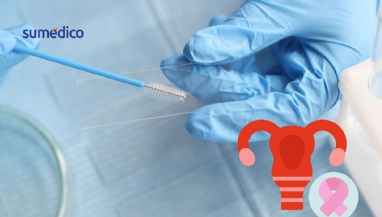 ¿Adiós al Papanicolaou? Aprueban primer prueba casera para detectar VPH