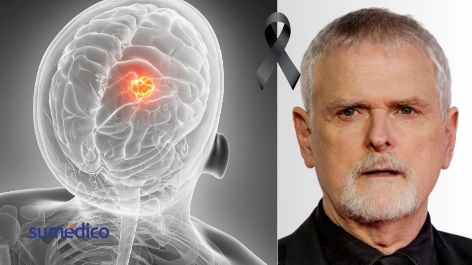 Las personas mayores tienen más riesgo de cáncer cerebral.
