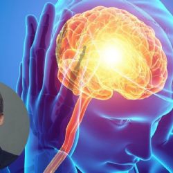 Prevención, la clave para vivir sin migraña