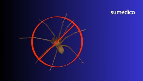 Así debes limpiar tu casa si quieres evitar la araña violinista