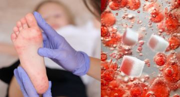 Diabetes: ¿Es normal sentir excesiva picazón en los pies?