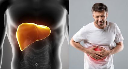 Hígado graso: Síntomas de esta enfermedad que NO debes ignorar