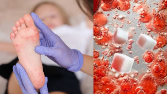 Diabetes: ¿Es normal sentir excesiva picazón en los pies?