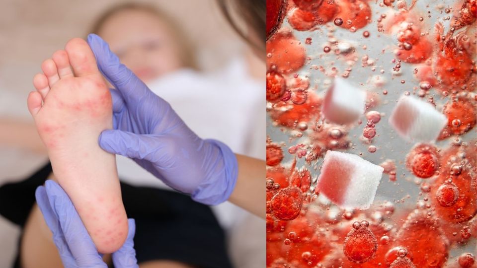 Las alteraciones en la glucosa pueden causar molestias en los pies.