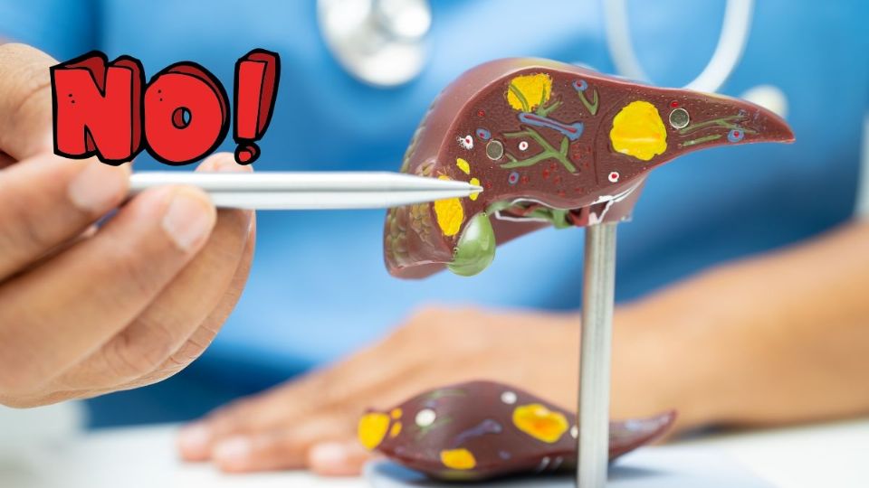 Se estima que hasta el 50% de los mexicanos padecen hígado graso.