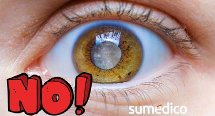 Cataratas: así las puedes prevenir