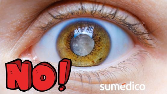 Cataratas: así las puedes prevenir