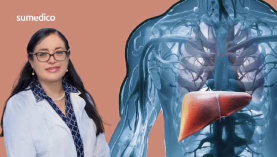 Eida Cerda, hepatóloga: ‘El hígado graso ya es una pandemia pero se puede prevenir'