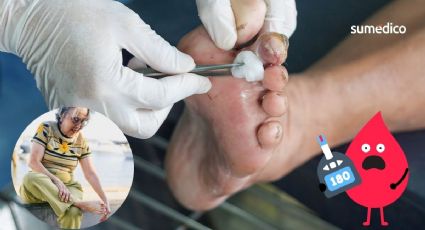 Úlceras diabéticas en adultos mayores: ¿cómo evitarlas?