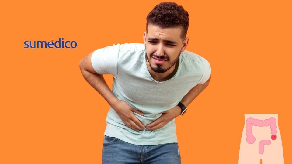 El cáncer de colon está aumentando entre jóvenes