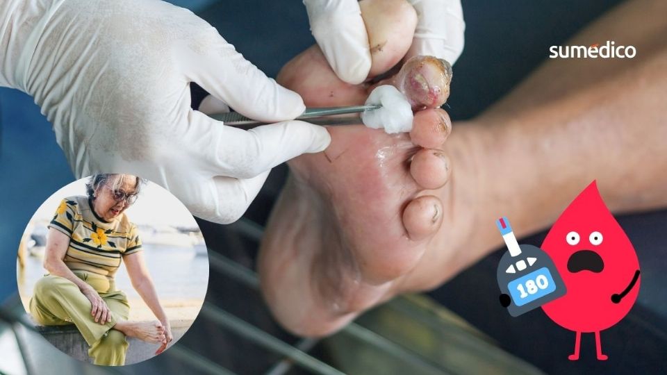 Las personas mayores pueden tener heridas en los pies sin darse cuenta.