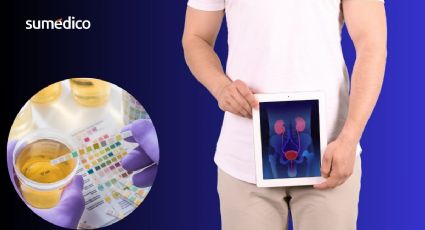 Así funciona la prueba casera para detectar cáncer de próstata en 15 minutos