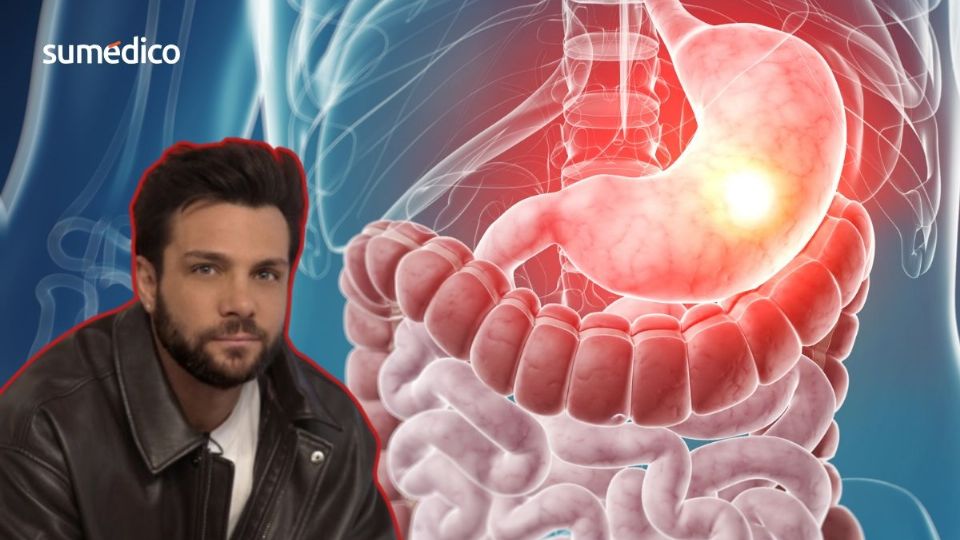 Nicola Porcella tuvo síntomas que requirieron hospitalización.