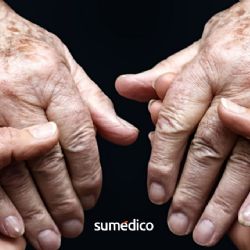 Cambios en las manos de adultos mayores y cuándo preocuparse