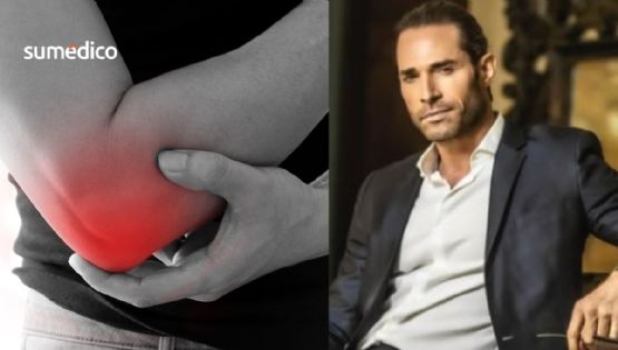 ¿Qué causa el codo de tenista, lesión que llevó al hospital a Sebastian Rulli?