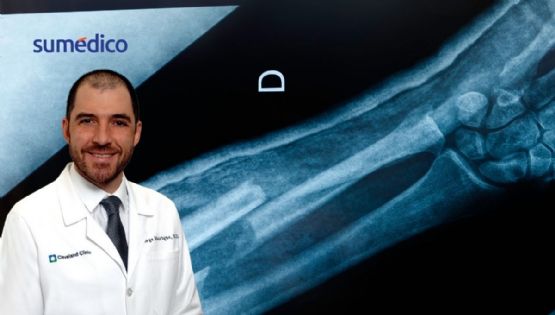 Oncólogo explica cómo detectar el sarcoma, un cáncer que afecta a jóvenes