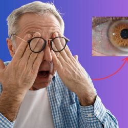 Qué significa una mancha gris en los ojos de adultos mayores