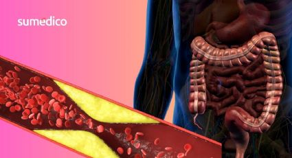 ¿Cómo influyen las bacterias intestinales en la obstrucción de las arterias?