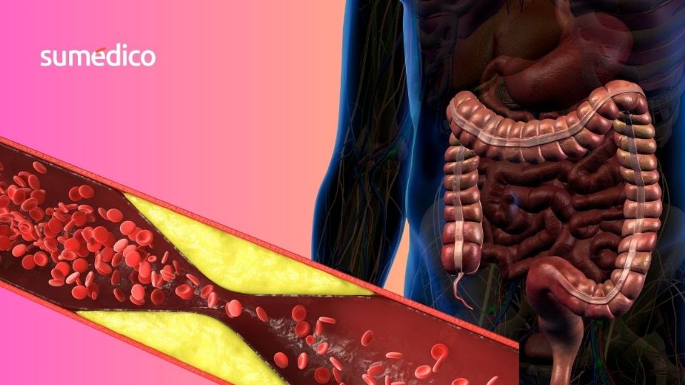 Las bacterias intestinales podrían influir en tu salud arterial.