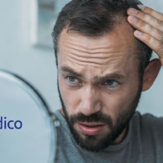 ¿Cómo afecta a la salud mental la alopecia?