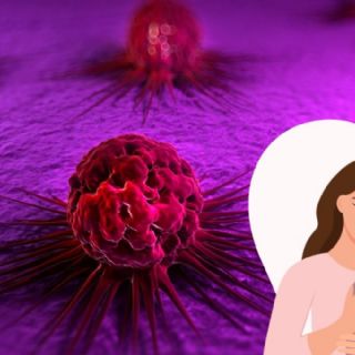 ¿Estamos ganando la guerra contra el cáncer? Avances que nos dan ventaja