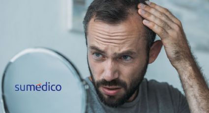 ¿Cómo afecta a la salud mental la alopecia?