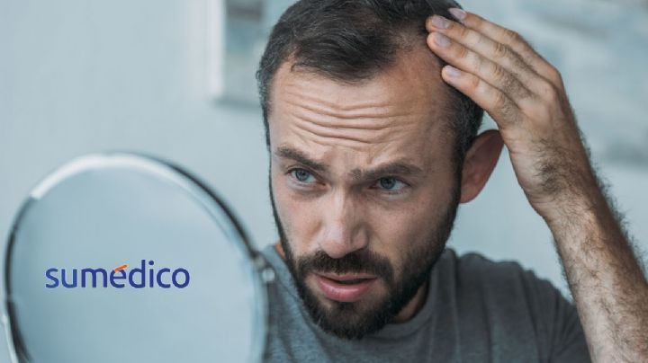 ¿Cómo afecta a la salud mental la alopecia?