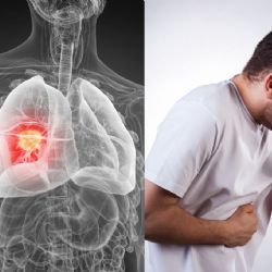 Cáncer de pulmón sin fumar: Estudio revela el factor invisible que lo causaría