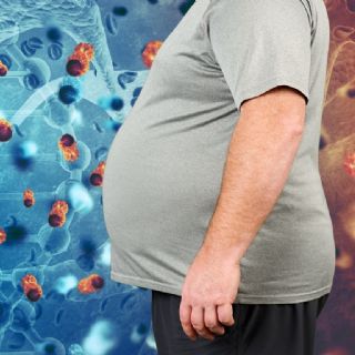Qué tipos de cáncer puedes prevenir al bajar de peso, según la ciencia