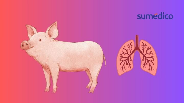 Realizan el primer trasplante de pulmón de cerdo a humano en China