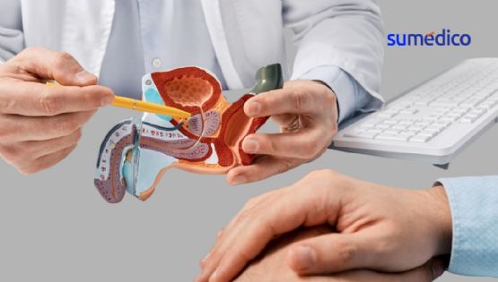 5 hábitos que se deben evitar para prevenir enfermedades en la próstata