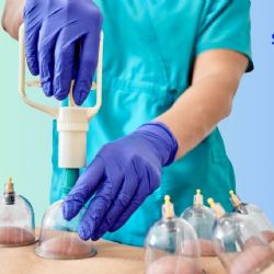 Qué es el 'cupping', pseudoterapia que alerta a las autoridades europeas