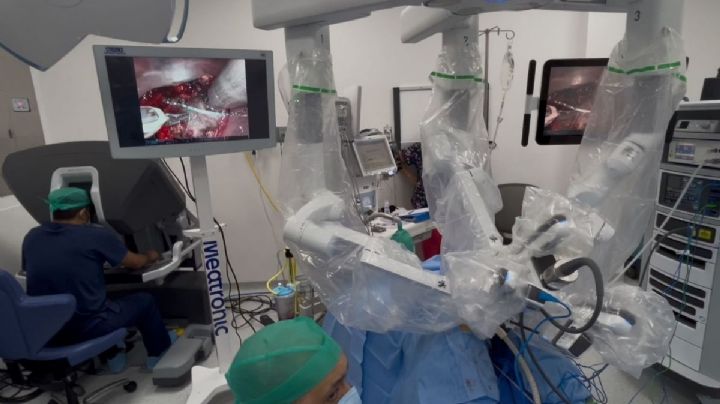 Cirugía robótica DaVinci, herramienta clave contra el cáncer de colon