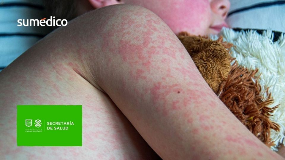 La Secretaría de Salud tiene preocupación por el Mundial