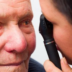 Cataratas: síntomas, causas y tratamiento